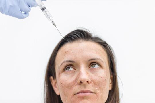 Photo of woman with dry skin and hand in medical glove with injection.