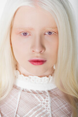 Portrait of albino woman looking at camera isolated on white.