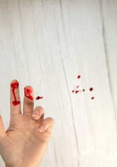 hand injury with blood, blood wound cut top view, copy space, medical concept needs stitches