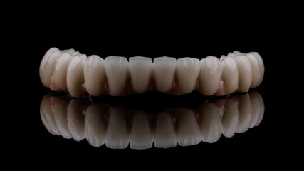 dentures on a black background, dental implants
