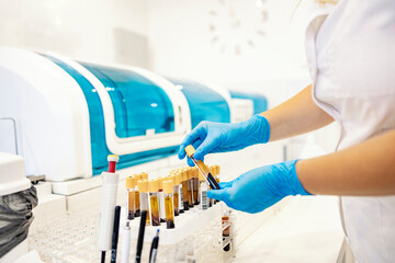 A test tubes with blood samples. A nurse standing in a laboratory and taking test tubes with blood samples ready for analysis. D-dimer and coagulation check during corona - obrazy, fototapety, plakaty