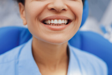 Woman showing healthy teeth at camera