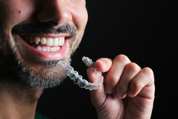bearded guy putting on transparent dental retainer - obrazy, fototapety, plakaty
