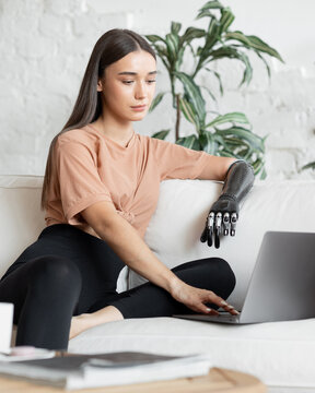 Woman with prosthetic arm working on laptop at home