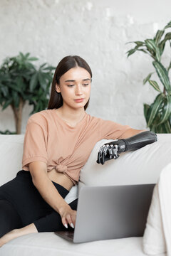 Woman with prosthetic arm working on laptop at home