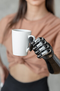 A girl with a prosthesis on her hand holds a cup