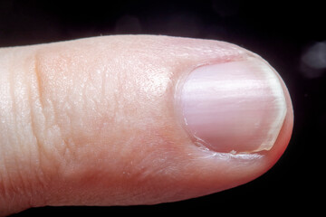 Close-up of male fingertips with nails. Photo in soft focus at high magnification.