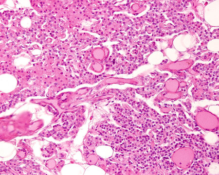 Human parathyroid gland. Cell types