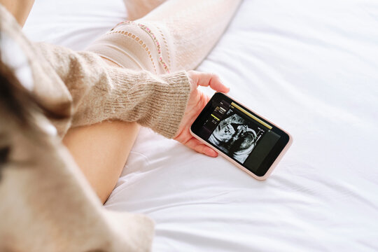 Woman with ultrasound picture on smartphone at home