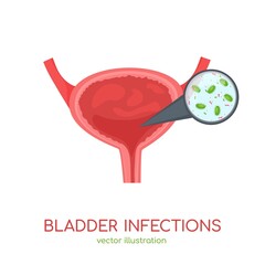Bladder infections icon. Editable vector illustration. Medical concept