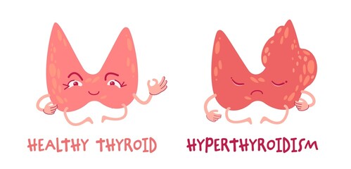 Healthy thyroid gland and hyperthyroidism, cartoon characters. Medical vector illustration. Endocrine system health