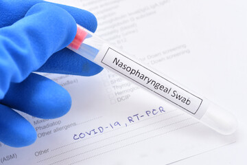 Nasopharyngeal swab from patient for COVID-19 test by using RT-PCR method 