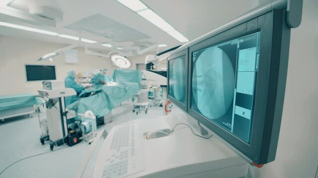 Monitors with bone scans set in the surgery room