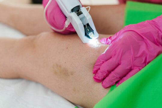 Expertise giving carboxytherapy treatment to mature woman