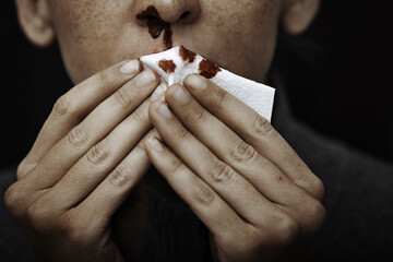 Mid adult woman holding tissue paper while nose bleeding