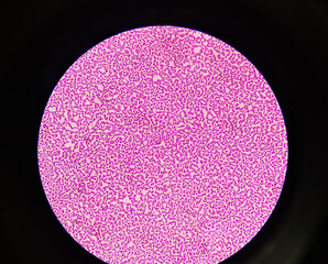 Blood culture colonies gram stained microscopic 100x show Salmonella paratyphi A (S. Paratyphi A)...