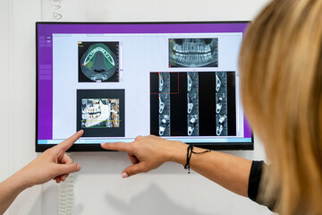 Female dentist and patient pointing at digital image on screen at medical clinic