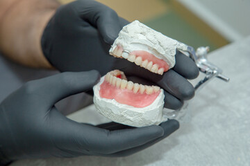 tooth mold for tooth restoration