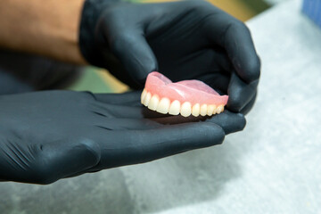 tooth mold for tooth restoration