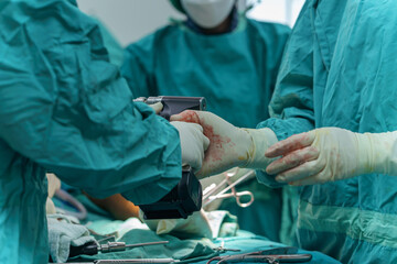 Assistant preparing instruments support Orthopedic doctor performing in plate and screw internal...