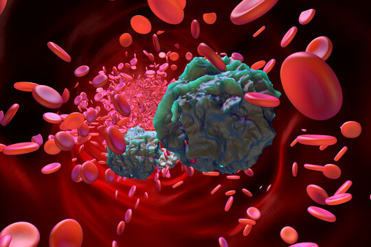Three dimensional render of leukemia cells in blood stream