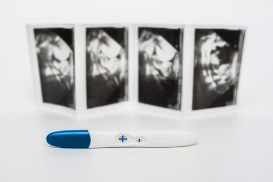 Positive pregnancy test on ultrasound photo. Positive pregnancy test result on a white background. Pregnancy test showing a positive result. Ultrasound photos of the child. Copy space