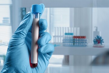 Doctor in the lab holding tubes of blood. Laboratory Technician with blood samples with a New...