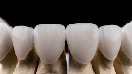 Fototapeta na wymiar Dental implants and dentures in close-up Siemke on a black background 
