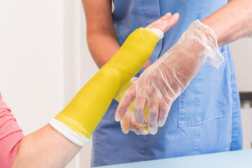 Surgery and Medical theme: Close up of an arm and wrist plaster  fiberglass cast therapy cover by yellow elastic bandage after sport accident. The nurse puts a red plaster cast on the woman arm.