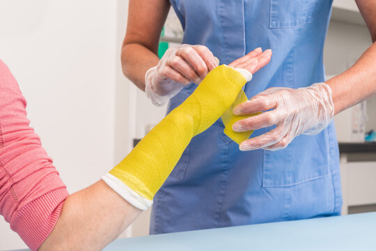 Surgery and Medical theme: Close up of an arm and wrist plaster  fiberglass cast therapy cover by yellow elastic bandage after sport accident. The nurse puts a red plaster cast on the woman arm.