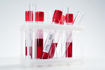 Tubes with blood samples in rack on white background. STD test