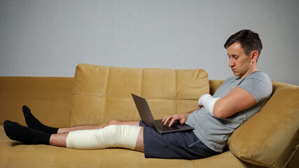 Man with short brunet hair wearing T-shirt with damaged knee and forearm in gypsum works distantly via laptop sitting on sofa in living room.