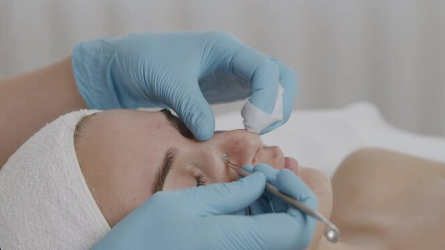 Hands of cosmetician, blackhead removal. Female face, beauty clinic.