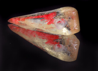 acrylic tooth endodontic canal