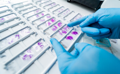 Hand in blue glove holding glass histology slides