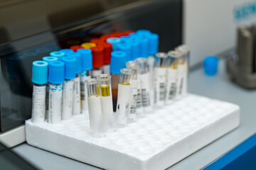 Modern medicine testing analises. Blood samples test tubes in medical laboratory.