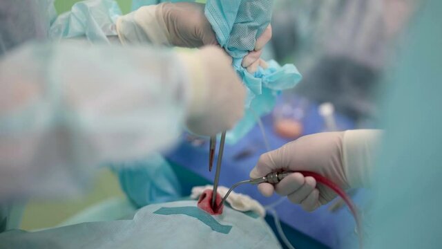 nasal septum correction in otolaryngology clinic, closeup in surgery during operation