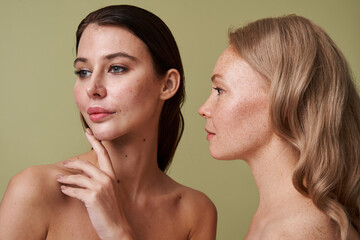 Brunette woman with skin imperfections looking away while freckled girl standing