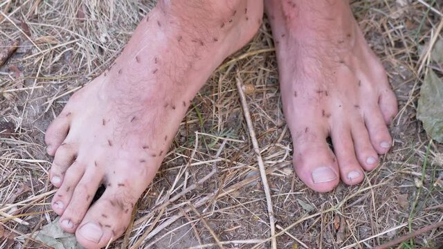 Army of Brown Ants is Crawling on Human Bare Legs Standing on Grass. Large number of ants of Formycin family attack, bites, runs on tourist hairy male feet. Camping outdoor. Summertime. 4K. Close up.