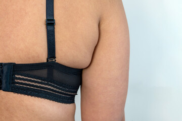 Close up chubby woman' body from back wearing wrong size of brassiere made meat folds out on back, excess weight of fat woman, small bra on fat body.  - obrazy, fototapety, plakaty
