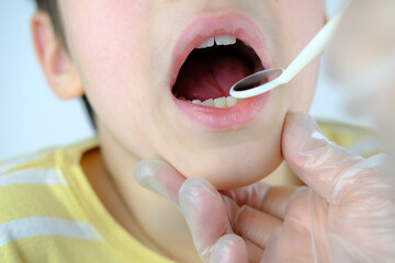 dentist, doctor examines oral cavity of small male patient, uses mouth mirror, closeup teeth child, concept dentistry, dental treatment, dental prosthetics, oral care, caries prevention