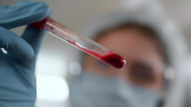 Technician hand holding test tube with blood. Doctor examining blood sample 