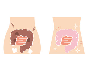 超不健康な腸と超健康な腸のセット