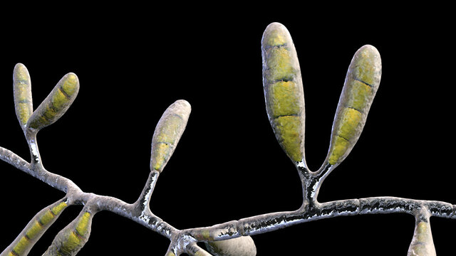 Microscopic fungi Epidermophyton floccosum, scientific illustration
