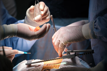 Closeup of professional doctor hands operating a patient during open heart surgery in surgical...