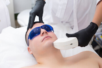 Close-up of the face of a cute young man in blue safety glasses during a laser hair removal procedure on his face
