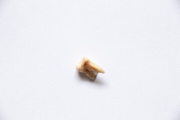 baby milk tooth pulled out lies on a white background, dentistry