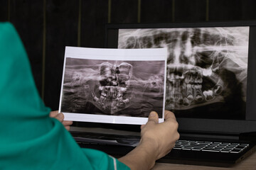panoramic X-ray of children's teeth of two jaws, orthopantomogram of children's teeth on laptop screens at the doctor's table © Виктория Котлярчук