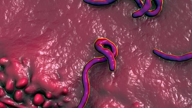 ebola virus