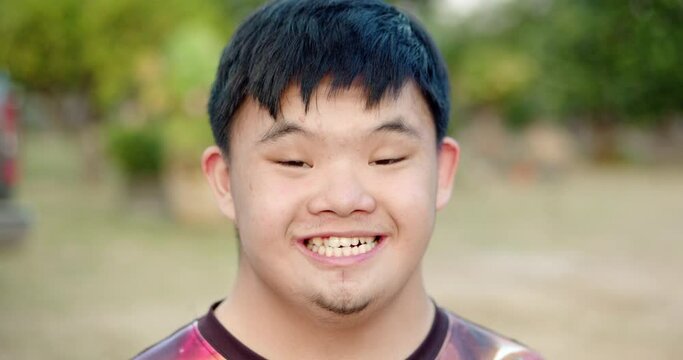 A young Asian male with Down syndrome is smiling happily.
